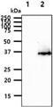 Sarcoglycan Delta antibody, MBS200310, MyBioSource, Western Blot image 
