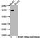 Signal Transducer And Activator Of Transcription 5A antibody, CSB-RA022814A694phHU, Cusabio, Western Blot image 