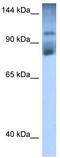 Homeodomain Interacting Protein Kinase 2 antibody, TA330617, Origene, Western Blot image 