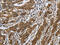 Interleukin 5 Receptor Subunit Alpha antibody, CSB-PA547751, Cusabio, Immunohistochemistry frozen image 