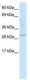 POU Class 6 Homeobox 1 antibody, TA329280, Origene, Western Blot image 