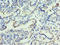 FOS Like 2, AP-1 Transcription Factor Subunit antibody, LS-C375729, Lifespan Biosciences, Immunohistochemistry paraffin image 
