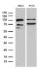 Phosphoglucomutase 2 Like 1 antibody, LS-C796268, Lifespan Biosciences, Western Blot image 