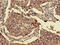 Forkhead Box N1 antibody, CSB-PA008829LA01HU, Cusabio, Immunohistochemistry frozen image 
