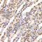 BUB3 Mitotic Checkpoint Protein antibody, A6536, ABclonal Technology, Immunohistochemistry paraffin image 