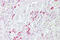 Frizzled Related Protein antibody, ARP54571_P050, Aviva Systems Biology, Immunohistochemistry paraffin image 