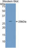 Parathyroid Hormone Like Hormone antibody, LS-C304244, Lifespan Biosciences, Western Blot image 