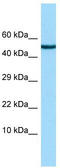 Chordin Like 2 antibody, TA338064, Origene, Western Blot image 