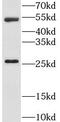 Lecithin Retinol Acyltransferase antibody, FNab04838, FineTest, Western Blot image 