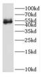 Interferon Related Developmental Regulator 2 antibody, FNab04152, FineTest, Western Blot image 