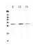 Kallikrein Related Peptidase 2 antibody, PA1626, Boster Biological Technology, Western Blot image 