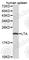 Lymphotoxin Alpha antibody, A1552, ABclonal Technology, Western Blot image 