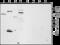 Transient Receptor Potential Cation Channel Subfamily M Member 4 antibody, GTX54863, GeneTex, Western Blot image 