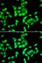ANTXR Cell Adhesion Molecule 2 antibody, PA5-76013, Invitrogen Antibodies, Immunofluorescence image 