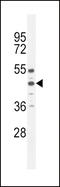 Angiotensin II type-1 receptor antibody, MBS9209160, MyBioSource, Western Blot image 
