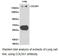 Collagen Type V Alpha 1 Chain antibody, LS-C192999, Lifespan Biosciences, Western Blot image 