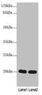 Calcium Binding Protein 5 antibody, LS-C397223, Lifespan Biosciences, Western Blot image 