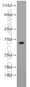 F-actin-capping protein subunit alpha-1 antibody, 55145-1-AP, Proteintech Group, Western Blot image 