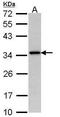 N-Acetyltransferase 1 antibody, PA5-22298, Invitrogen Antibodies, Western Blot image 