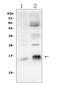 Baculoviral IAP repeat-containing protein 5 antibody, RP1026, Boster Biological Technology, Western Blot image 