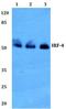 Interferon Regulatory Factor 4 antibody, GTX66692, GeneTex, Western Blot image 