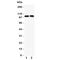 Potassium Voltage-Gated Channel Subfamily Q Member 5 antibody, R31424, NSJ Bioreagents, Western Blot image 