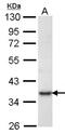 Phosphoribosyl Pyrophosphate Synthetase 1 antibody, NBP1-31654, Novus Biologicals, Western Blot image 
