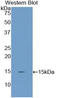 Uncoupling Protein 2 antibody, LS-C300165, Lifespan Biosciences, Western Blot image 