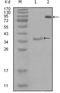 EPH Receptor A4 antibody, M01860, Boster Biological Technology, Western Blot image 
