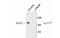 Arachidonate 5-Lipoxygenase antibody, MBS835508, MyBioSource, Western Blot image 