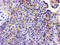 Glutathione S-Transferase Omega 2 antibody, M05239, Boster Biological Technology, Immunohistochemistry paraffin image 