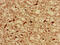 Lysine Acetyltransferase 5 antibody, CSB-PA17849A0Rb, Cusabio, Immunohistochemistry paraffin image 