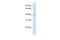 Translocation Associated Membrane Protein 2 antibody, GTX46391, GeneTex, Western Blot image 