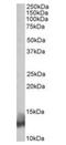 Phospholamban antibody, orb20619, Biorbyt, Western Blot image 