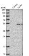 Growth Differentiation Factor 3 antibody, NBP1-86443, Novus Biologicals, Western Blot image 