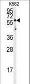 Histidine Rich Glycoprotein antibody, LS-C100915, Lifespan Biosciences, Western Blot image 