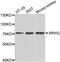 Ariadne RBR E3 Ubiquitin Protein Ligase 2 antibody, abx006642, Abbexa, Western Blot image 