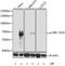 SRC Proto-Oncogene, Non-Receptor Tyrosine Kinase antibody, AP0185, ABclonal Technology, Western Blot image 