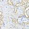 Chorionic Gonadotropin Subunit Beta 7 antibody, GTX66027, GeneTex, Immunohistochemistry paraffin image 