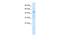 Zinc Finger Protein 358 antibody, A15768, Boster Biological Technology, Western Blot image 