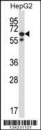 Protein Phosphatase, Mg2+/Mn2+ Dependent 1G antibody, 57-704, ProSci, Western Blot image 