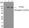 Protein Tyrosine Kinase 2 Beta antibody, PA5-37573, Invitrogen Antibodies, Western Blot image 