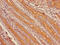 Cytochrome P450 3A4 antibody, CSB-PA006439LA01HU, Cusabio, Immunohistochemistry paraffin image 