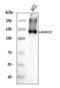 Laminin Subunit Gamma 2 antibody, A03214, Boster Biological Technology, Western Blot image 
