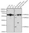 Transmembrane protease serine 2 antibody, GTX64544, GeneTex, Western Blot image 