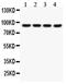 Solute Carrier Family 6 Member 4 antibody, PA5-80032, Invitrogen Antibodies, Western Blot image 