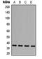 Galactosidase Beta 1 Like 3 antibody, LS-C356060, Lifespan Biosciences, Western Blot image 