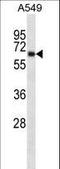 Potassium Voltage-Gated Channel Subfamily A Member 3 antibody, LS-C165410, Lifespan Biosciences, Western Blot image 