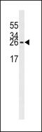 Eukaryotic Translation Initiation Factor 4E antibody, MBS9200180, MyBioSource, Western Blot image 