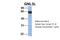 Guanine nucleotide-binding protein-like 3-like protein antibody, ARP58799_P050, Aviva Systems Biology, Western Blot image 